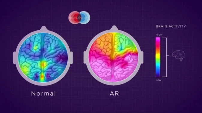 arの脳への影響